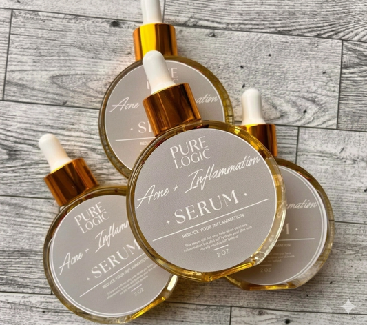 Acne Be Gone Serum